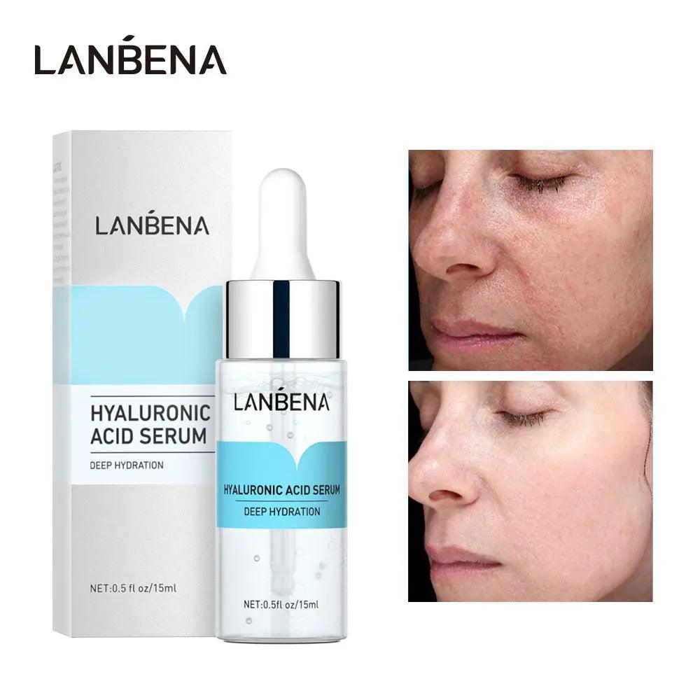 MMU014 LANBENA Hyaluronic Acid Serum - Mariam's Collection